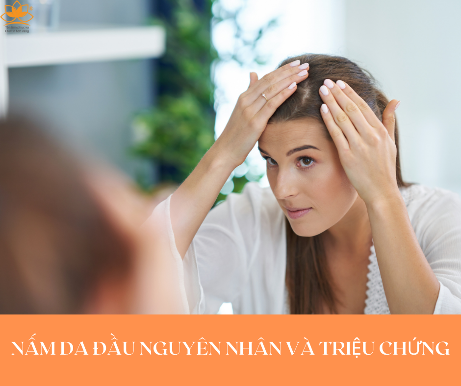 NGUYÊN NHÂN TRIỆU CHỨNG CỦA NẤM DA ĐẦU